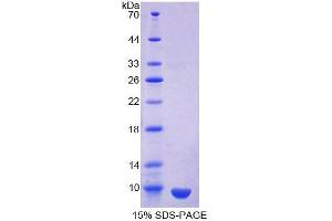 SDS-PAGE (SDS) image for Secretoglobin, Family 1A, Member 1 (Uteroglobin) (SCGB1A1) (AA 23-91) protein (His tag) (ABIN1170066) (SCGB1A1 Protein (AA 23-91) (His tag))