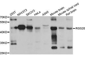 Western blot analysis of extracts of various cell lines, using RGS20 antibody. (RGS20 Antikörper)