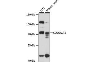 Western blot analysis of extracts of various cell lines, using COLGALT2 antibody (ABIN6294221) at 1:1000 dilution.