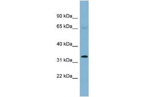 WB Suggested Anti-HEY1 Antibody Titration:  0. (HEY1 Antikörper  (Middle Region))