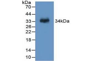 Western blot analysis of recombinant Rat F13A1. (F13A1 Antikörper  (AA 140-377))