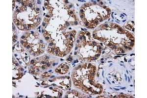 Immunohistochemical staining of paraffin-embedded liver tissue using anti-PASKmouse monoclonal antibody. (PASK Antikörper)