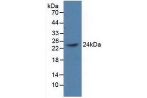 Western blot analysis of recombinant Human PCGF4. (BMI1 Antikörper  (AA 152-289))
