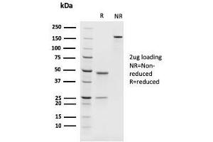 SDS-PAGE Analysis Purified PAX8 Recombinant Mouse Monoclonal Antibody (rPAX8/1492). (Rekombinanter PAX8 Antikörper  (AA 60-261))
