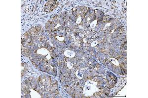 IHC analysis of CCNB1 using anti-CCNB1 antibody (ABIN7599335). (Cyclin B1 Antikörper  (AA 1-383))