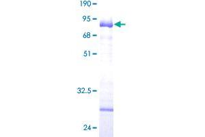 Image no. 1 for Collagen, Type IX, alpha 1 (COL9A1) (AA 1-328) protein (GST tag) (ABIN1349990)