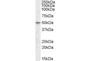 Image no. 1 for anti-TEA Domain Family Member 2 (TEAD2) (Internal Region) antibody (ABIN375139) (TEAD2 Antikörper  (Internal Region))