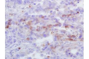 Immunohistochemistry (Paraffin-embedded Sections) (IHC (p)) image for anti-Chemokine (C-X-C Motif) Ligand 1 (Melanoma Growth Stimulating Activity, Alpha) (CXCL1) (AA 51-107) antibody (ABIN2173443)