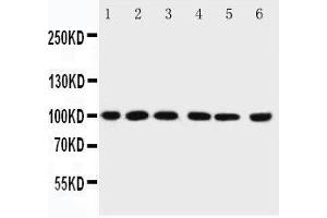 PIAS1 Antikörper  (C-Term)