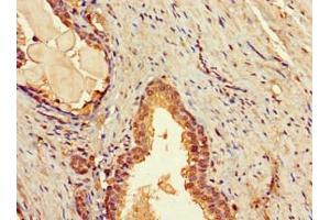Immunohistochemistry of paraffin-embedded human prostate tissue using ABIN7171658 at dilution of 1:100 (TBC1D7 Antikörper  (AA 1-293))