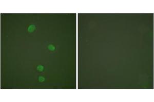 Immunofluorescence analysis of HepG2 cells, using MCM5 antibody (ABIN5976453). (MCM5 Antikörper  (N-Term))