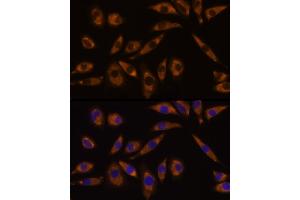 Immunofluorescence (IF) image for anti-Guanine Nucleotide Binding Protein (G Protein), Q Polypeptide (GNAQ) (AA 1-359) antibody (ABIN7267542)