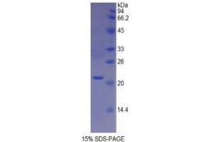SDS-PAGE analysis of Mouse Involucrin Protein.