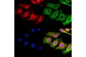 ABIN6259062 and ABIN6273551 staining Hela cells by IF/ICC.
