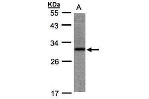 WB Image Sample(30 ug whole cell lysate) A:Raji , 10% SDS PAGE antibody diluted at 1:1000 (ANKRD7 Antikörper)