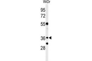 Western Blotting (WB) image for anti-Non-SMC Element 4 Homolog A (NSMCE4A) antibody (ABIN3004373) (NSMCE4A Antikörper)