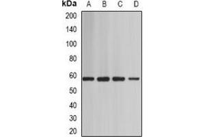Western blot analysis of BAF60A expression in Jurkat (A), mouse heart (B), mouse testis (C), rat brain (D) whole cell lysates. (SMARCD1 Antikörper)