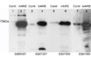 Western Blotting (WB) image for anti-Autoimmune Regulator (AIRE) (C-Term) antibody (ABIN2465375) (AIRE Antikörper  (C-Term))