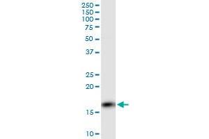 PPP3R1 monoclonal antibody (M01), clone 4E1. (PPP3R1 Antikörper  (AA 1-170))