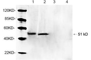 Western blot analysis of tissue lysates using 1 µg/mL Rabbit Anti-Parkin Polyclonal Antibody (ABIN398785) Lane 1, 3: Mouse brain tissue lysateLane 2, 4: Rat brain tissue lysate Primary antibody: Lane 1, 2: Rabbit Anti-Parkin Polyclonal AntibodyLane 3, 4: Rabbit Anti-Parkin Polyclonal Antibody pre-incubated with immunizing peptideThe signal was developed with IRDyeTM 800 Conjugated Goat Anti-Rabbit IgG. (Parkin Antikörper  (AA 300-350))