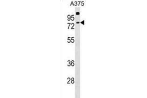 Western Blotting (WB) image for anti-Transketolase-Like 2 (TKTL2) antibody (ABIN2999404) (TKTL2 Antikörper)