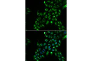 Immunofluorescence analysis of U2OS cells using TSPAN7 antibody. (Tetraspanin 7 Antikörper)