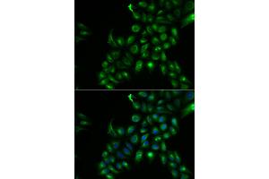 Immunofluorescence analysis of U2OS cells using TSPAN7 antibody. (Tetraspanin 7 Antikörper)