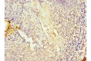 Immunohistochemistry of paraffin-embedded human tonsil tissue using ABIN7157487 at dilution of 1:100 (UPF0469 Protein KIAA0907 (KHDC4) (AA 1-241) Antikörper)