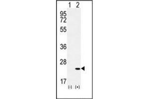 Western blot analysis of CRH (arrow) using Corticoliberin Antibody (C-term) Cat. (CRH Antikörper  (C-Term))