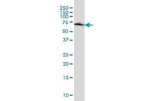 Western Blotting (WB) image for anti-ERO1-Like Protein alpha (ERO1L) (AA 90-179) antibody (ABIN599232) (ERO1L Antikörper  (AA 90-179))