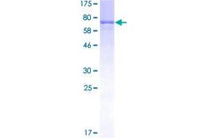 Image no. 2 for Mitogen-Activated Protein Kinase-Activated Protein Kinase 5 (MAPKAPK5) (AA 1-471) protein (GST tag) (ABIN1310330)
