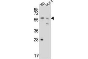 Western Blotting (WB) image for anti-Phosphogluconate Dehydrogenase (PGD) antibody (ABIN3002350)