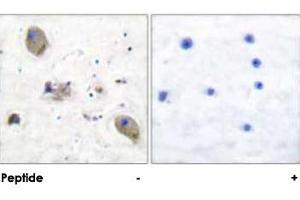 Immunohistochemical analysis of paraffin-embedded human brain tissue using LYN polyclonal antibody . (CD180 Antikörper)