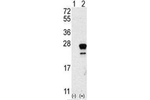 Western blot analysis of NRAS antibody and 293 cell lysate either nontransfected (Lane 1) or transiently transfected with the NRAS gene (2). (GTPase NRas Antikörper  (AA 72-101))