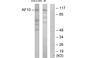 Western blot analysis of extracts from COLO205 cells and Jurkat cells, using AF10 antibody. (MLLT10 Antikörper  (Internal Region))
