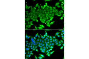 Immunofluorescence analysis of A549 cells using TTF2 antibody. (TTF2 Antikörper)