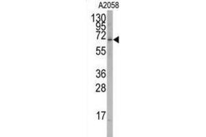 Western Blotting (WB) image for anti-RAR-Related Orphan Receptor A (RORA) antibody (ABIN2995882) (RORA Antikörper)