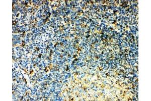 IHC-P: CCR3 antibody testing of human tonsil tissue