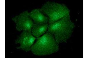 ICC/IF analysis of BMP2 in Hep3B cells line, stained with monoclonal anti-human BMP2 antibody (1:100) with goat anti-mouse IgG-Alexa fluor 488 conjugate (Green). (BMP2 Antikörper  (AA 283-396))