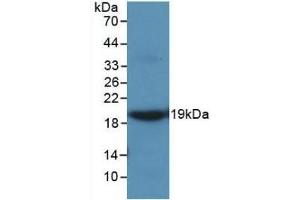 Detection of Recombinant MMP9, Rat using Monoclonal Antibody to Matrix Metalloproteinase 9 (MMP9) (MMP 9 Antikörper  (AA 226-391))