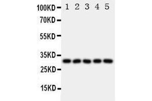 Anti-LOX 1 antibody, Western blotting All lanes: Anti LOX 1  at 0. (OLR1 Antikörper  (N-Term))