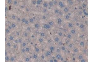 Immunohistochemistry (IHC) image for anti-Matrix Metallopeptidase 3 (Stromelysin 1, Progelatinase) (MMP3) (AA 98-475) antibody (ABIN7442972)