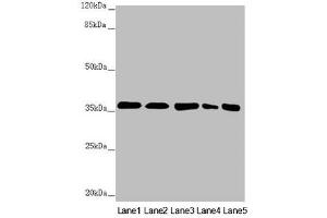 Western blot All lanes: GNB2 antibody at 2. (GNB2 Antikörper  (AA 1-340))