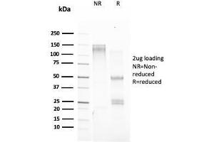 SDS-PAGE Analysis Purified TFF1/ps2 Mouse Monoclonal Antibody (TFF1/2133).