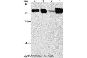 Western blot analysis of Hepg2 and hela cell, human fetal kidney and liver tissue, using ACSL4 Polyclonal Antibody at dilution of 1:650 (ACSL4 Antikörper)