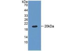 Detection of Recombinant MRPL1, Human using Polyclonal Antibody to Mitochondrial Ribosomal Protein L1 (MRPL1) (MRPL1 Antikörper  (AA 147-285))