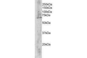 Image no. 1 for anti-Transducin (Beta)-Like 1X-Linked (TBL1X) (C-Term) antibody (ABIN374165) (TBL1X Antikörper  (C-Term))