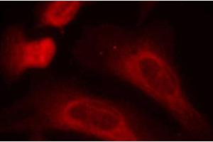 Immunofluorescence analysis of methanol-fixed HeLa cells using Phospho-STAT1(S727) Polyclonal Antibody