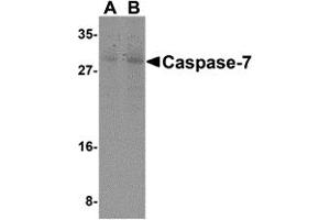 Western Blotting (WB) image for anti-Caspase 7, Apoptosis-Related Cysteine Peptidase (CASP7) (N-Term) antibody (ABIN1031300) (Caspase 7 Antikörper  (N-Term))