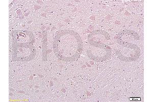 Formalin-fixed and paraffin embedded: rat brain tissue labeled with Anti-MAP1A Polyclonal Antibody (ABIN735308), Unconjugated at 1:200, followed by conjugation to the secondary antibody and DAB staining (MAP1A Antikörper  (AA 2651-2750))